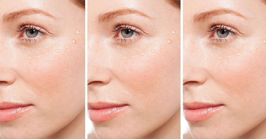 Sérum acide hyaluronique : guide anti‑âge pour peau lisse